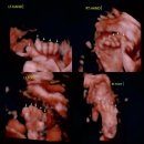 클린스쿨인천 - 미추홀구 독배로 311 | Our baby 09. 27~28주 임산부 일기 (28주 입체초음파)