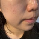 배방한라비발디아파트경로당 | [아산/배방] 포유에스테틱 윤곽관리 림프관리 후기