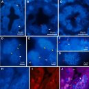 새우간췌장 감염 Enterocytozoon hepatopenaei 학명이 Ecytonucleospora hepatopenae로 변경 이미지