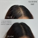 송하피부샵