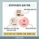 초읍한의원 이미지