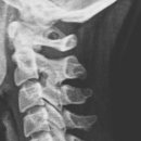 새한신경외과의원 이미지