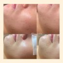 블랑드스킨 이미지