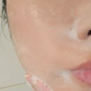 피부 오돌토돌 좁쌀 홈케어 관리방법