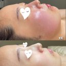 삼천포피부관리실바이엘 네이버블로그