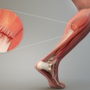 어진서부한의원 이미지