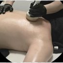 문스킨&바디 이미지