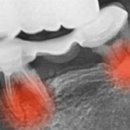 수원탑플란트치과의원 이미지