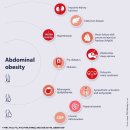 (주)국제응급환자이송센터 | 9. 글로벌 비만 대사수술 센터
