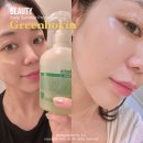그린박신 얼리썸머 프로모션 코나피딜 공구 세트 가격 후기