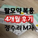 ㈜엘앤씨바이오 | 메가페시아 4개월 복용｜정수리 탈모약 프로페시아 카피약 효과와 가격, 부작용 후기 총정리