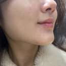 리나스킨케어