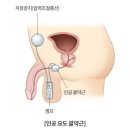 드림온비뇨의학과의원 네이버블로그