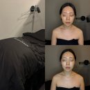 1366 | 망포피부관리 추천, 수원여드름관리 잘하는 몽스킨에서 써큘테라피 후기