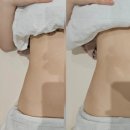 백만프라자 | 안산윤곽관리 온기 에스테틱 이혈테라피 후기