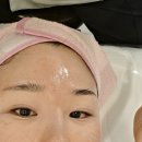 압구정 피부관리 더윤에스테틱 트러블관리 솔직후기