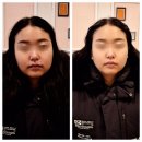 탑온누리약국 | 상도동피부관리 :: 행복에스테틱 | 신대방삼거리 신부관리 두골비 관리 후기