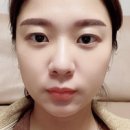 케이와이엘