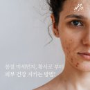 시엔느스킨