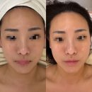 상대동6 | 대전웨딩윤곽 잘하는 곳｜유성상대동피부관리 오늘스킨 수분관리 후기