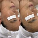 기  전 | 순천피부관리｜붉은기·건조 피부, 결혼식 전 물방울 관리 후기