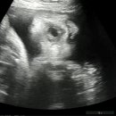 숯고방 꼬기냉면 이미지