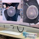 서울삼성최내과의원 | 후천성 머리 변형, 사두 사경 치료일기 - 삼성서울병원 진료 후 잠실 이노야드 최종계약 (브랜드별 가격...