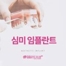 남원심플란트치과의원 네이버블로그