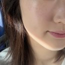 비키뷰티 | 강동 스킨플래닝 미작뷰티 강동점 후기 | 얼굴 솜털 제거 각질 정리 후 화장 잘 먹는 피부