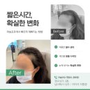 머슬디자인 | 창원헤어라인왁싱 머슬포유 재방문후기