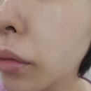 강서 마곡피부관리 3세대 연예인필링 물광필링은 트윙클에스테틱 마곡역본점