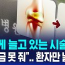 빠르게 늘고 있는 시술인데…"보험금 못 줘" 환자만 날벼락 이미지