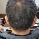 스타키보청기 안동점 이미지