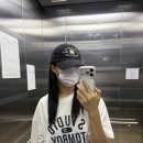 루나안경 | 루나의원 루비레이저 기미 주근깨 박멸기 (1일차~12일 차 시술 후기)
