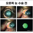 이소메디칼 이미지