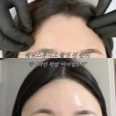 가자 왁싱&뷰티 | [구미 원평동 왁싱] 아이엠뷰티 헤어라인·뒷목 왁싱 후기 — 웨딩 스튜디오 촬영 준비 완료