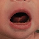 베스트아이들병원 | 동탄 아기설소대 가능병원 베스트아이들병원 후기