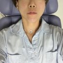 라임 | 울쎄라피프라임 효과 후기
