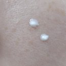 타임의원 | [부천/피부] 부천 타임의원 레이저 시술 후기 : 흑자, 기미, 점