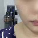 김나현 에스테틱 방문 후기, 청주 얼굴 경락 / 윤곽 관리
