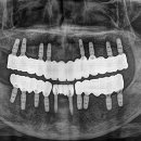 블루커스텀 치과기공소 이미지