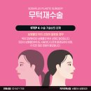 더자연스러움