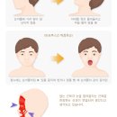 봉천 한의원 네이버블로그