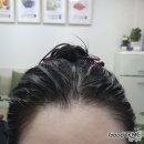 Q사랑염색방 | 계양구두피클리닉, 작전동미용실 큐사랑작전점 방문후기 (두피케어, 볼륨영양, 뿌리염색)