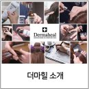 엠지에프두피탈모전문센터