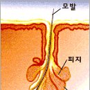 [대구중구피부과] 10대만의 전유물?? NO! 여드름, 알고 관리하자 [여드름] 이미지