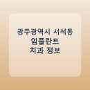 조선대학교치과병원 | 광주광역시 서석동 치과 임플란트 종류 가격 및 실제 후기 총정리