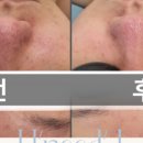 제이유니드 이미지