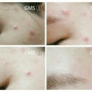 지엠에스(GMS) 이미지