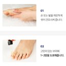 짐큐어 | 셀라큐어 NTIS 솔루션 발톱케어 문제성 발톱 홈케어 후기